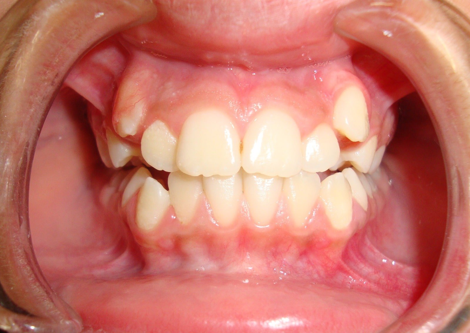 Before image