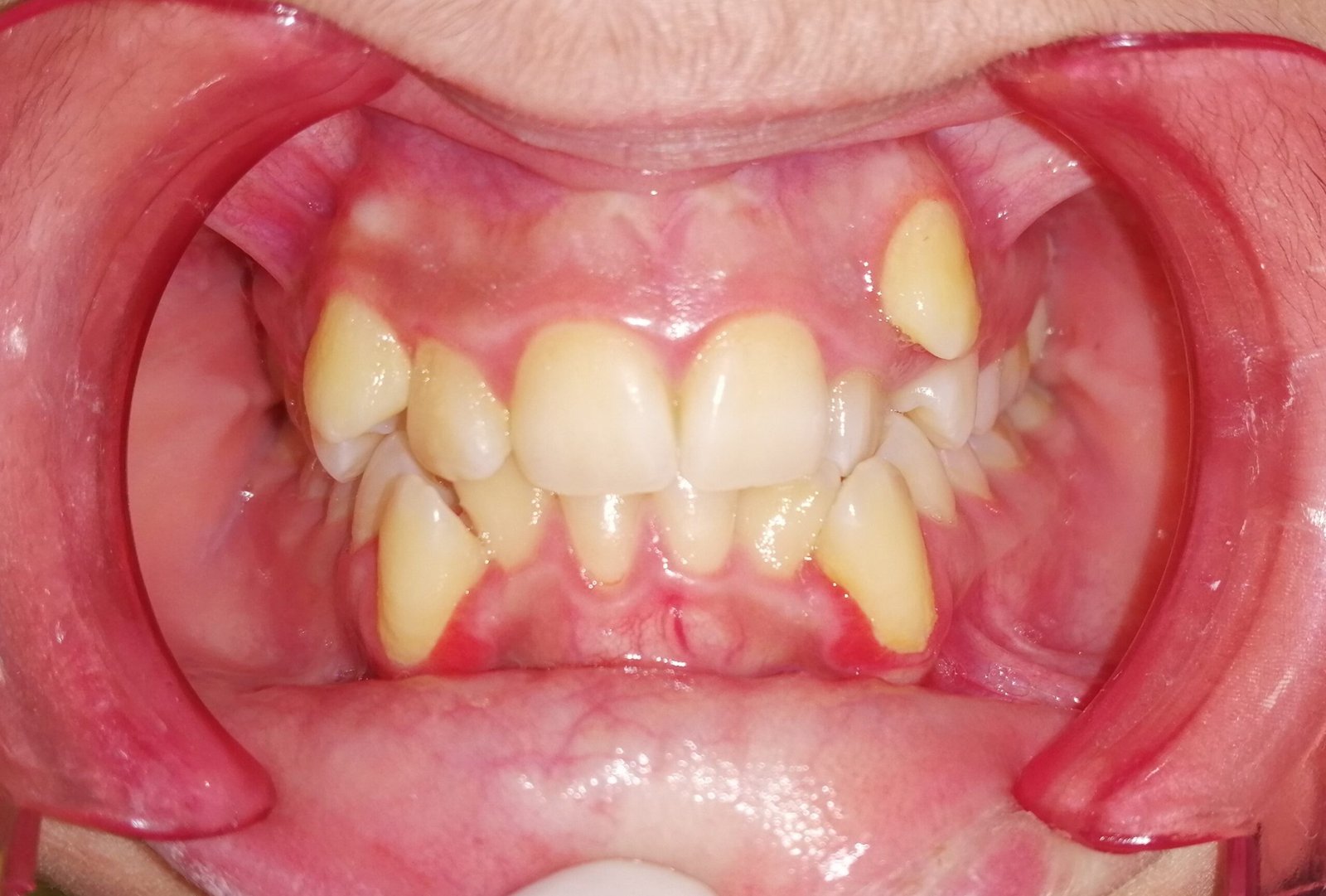 Before image