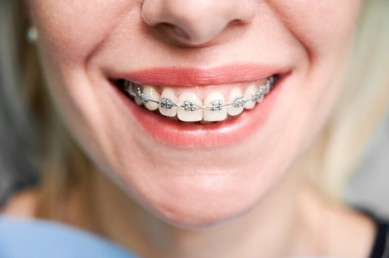 Comprehensive Guide: How to Choose the Right Orthodontist in Dubai?